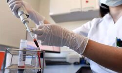 കൊവിഡ് പ്ലാസ്മ തെറാപ്പി അനുമതി; ആദ്യഘട്ടത്തിൽ കേരളത്തിലെ സ്ഥാപനങ്ങളില്ല