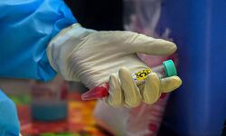 കൊവിഡ്: എറണാകുളത്തിന് ആശ്വാസം; ഇന്ന് ആര്ക്കും രോഗം സ്ഥിരീകരിച്ചില്ല കൊവിഡ്: എറണാകുളത്തിന് ആശ്വാസം; ഇന്ന് ആര്ക്കും രോഗം സ്ഥിരീകരിച്ചില്ല