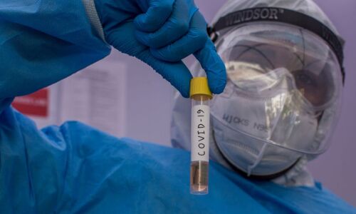 കൊവിഡ് 19 : ചികില്‍സാ മേഖല പ്രതീക്ഷയില്‍