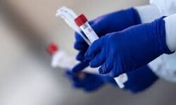 കൊവിഡ് 19: ഒമാനില് ഇന്ന് അഞ്ചു മരണം; 770 പുതിയ കേസുകള് കൊവിഡ് 19: ഒമാനില് ഇന്ന് അഞ്ചു മരണം; 770 പുതിയ കേസുകള്