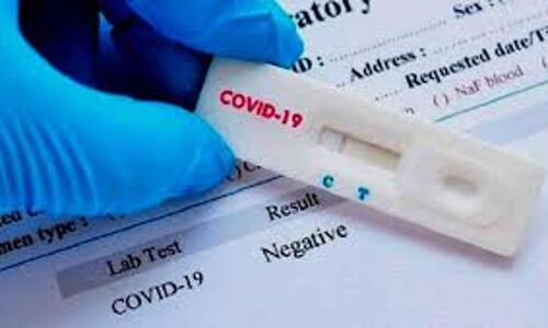 റാപ്പിഡ് ടെസ്റ്റ് ; കോട്ടയത്ത് ഇതുവരെ ശേഖരിച്ചത് 187 സാമ്പിളുകള് റാപ്പിഡ് ടെസ്റ്റ് ; കോട്ടയത്ത് ഇതുവരെ ശേഖരിച്ചത് 187 സാമ്പിളുകള്