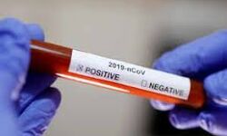 കുവൈത്തില് തിരിച്ചെത്തിയ മൂന്നു മലയാളി ആരോഗ്യ പ്രവര്ത്തകര്ക്ക് കൊവിഡ് ബാധ കുവൈത്തില് തിരിച്ചെത്തിയ മൂന്നു മലയാളി ആരോഗ്യ പ്രവര്ത്തകര്ക്ക് കൊവിഡ് ബാധ