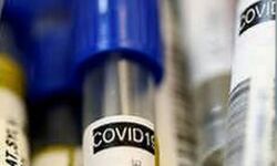 പ്രൈവറ്റ് സെക്രട്ടറിയ്ക്ക് കൊവിഡ്: തെലങ്കാന ധനമന്ത്രി ക്വാറന്റീനില്‍