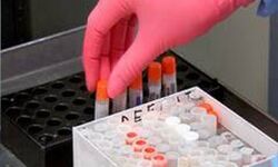 കൊവിഡ് 19: കോഴിക്കോട് 1390 പേര്‍ കൂടി നിരീക്ഷണത്തില്‍