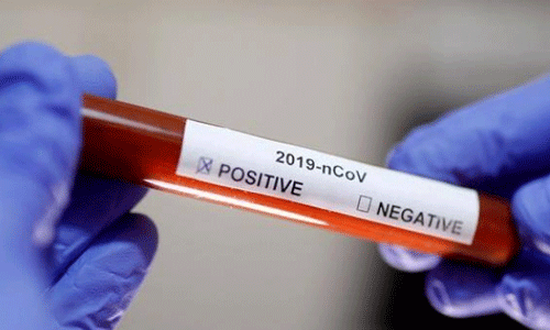 കൊവിഡ് 19: മലപ്പുറം ജില്ലയില്‍ 15 പേര്‍ക്ക് കൂടി വൈറസ്ബാധ സ്ഥിരീകരിച്ചു