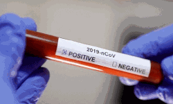 കൊവിഡ് 19: മലപ്പുറം ജില്ലയില്‍ 15 പേര്‍ക്ക് കൂടി വൈറസ്ബാധ സ്ഥിരീകരിച്ചു