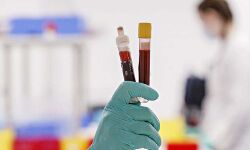 ലോക മനുഷ്യാവകാശ ദിനത്തില്‍ പ്ലാസ്മദാന ക്യാംപ്