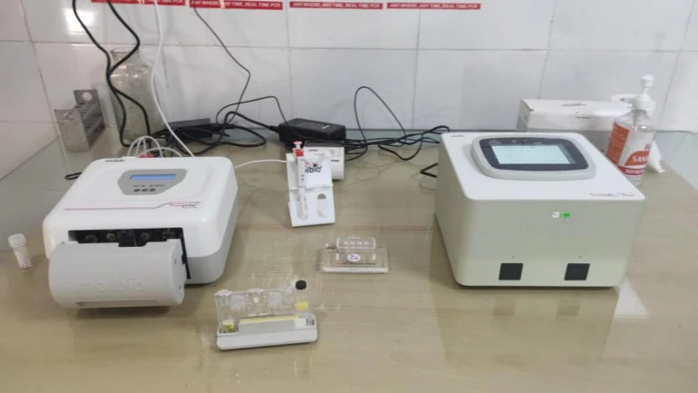 പ്രവാസി പരിശോധന: ട്രൂനാറ്റ് ടെസ്റ്റ് കിറ്റ് ലഭ്യമാക്കാന് ശ്രമം പ്രവാസി പരിശോധന: ട്രൂനാറ്റ് ടെസ്റ്റ് കിറ്റ് ലഭ്യമാക്കാന് ശ്രമം