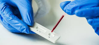 നിരീക്ഷണകേന്ദ്രത്തിൽ മദ്യപിച്ച് ബഹളമുണ്ടാക്കിയ യുവാവിന് കോവിഡ് സ്ഥിരീകരിച്ചു