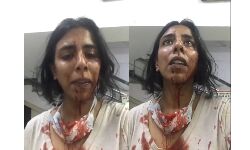 ഡല്ഹിയില് തെരുവുനായ സംരക്ഷണ പ്രവര്ത്തകര്ക്ക് ക്രൂരമര്ദ്ദനം(വീഡിയോ) ഡല്ഹിയില് തെരുവുനായ സംരക്ഷണ പ്രവര്ത്തകര്ക്ക് ക്രൂരമര്ദ്ദനം(വീഡിയോ)