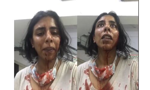 ഡല്‍ഹിയില്‍ തെരുവുനായ സംരക്ഷണ പ്രവര്‍ത്തകര്‍ക്ക് ക്രൂരമര്‍ദ്ദനം(വീഡിയോ)