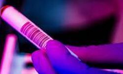 കാസര്‍കോട്ട് മരിച്ച സുള്ള്യയിലെ വ്യാപാരിക്ക് കൊവിഡെന്ന് സംശയം