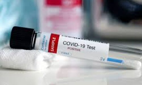 വയനാട് ജില്ലയില്‍ എട്ടു പേര്‍ക്ക് കൂടി കൊവിഡ് സ്ഥിരീകരിച്ചു