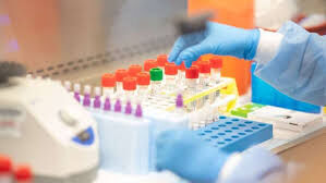 മലപ്പുറം ജില്ലയില് 46 പേര്ക്ക് കൂടി കൊവിഡ് സ്ഥിരീകരിച്ചു മലപ്പുറം ജില്ലയില് 46 പേര്ക്ക് കൂടി കൊവിഡ് സ്ഥിരീകരിച്ചു