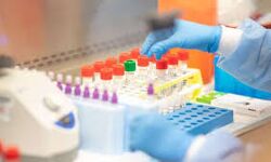 മലപ്പുറം ജില്ലയില് 46 പേര്ക്ക് കൂടി കൊവിഡ് സ്ഥിരീകരിച്ചു മലപ്പുറം ജില്ലയില് 46 പേര്ക്ക് കൂടി കൊവിഡ് സ്ഥിരീകരിച്ചു