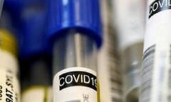 തമിഴ്നാട്ടില് പുതുതായി 3756 കൊവിഡ് രോഗികള്, 24 മണിക്കൂറിനുള്ളില് 64 മരണം തമിഴ്നാട്ടില് പുതുതായി 3756 കൊവിഡ് രോഗികള്, 24 മണിക്കൂറിനുള്ളില് 64 മരണം