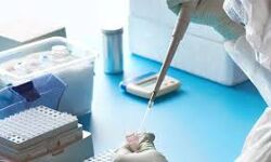 കൊവിഡ്: മലപ്പുറം ജില്ലയില്‍ 47 പേര്‍ക്ക് കൂടി രോഗബാധ സ്ഥിരീകരിച്ചു