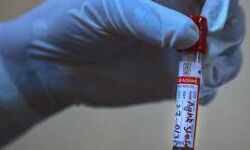 മലപ്പുറം ജില്ലയില്‍ 58 പേര്‍ക്ക് കൂടി കൊവിഡ് സ്ഥിരീകരിച്ചു