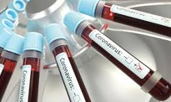 കൊവിഡ്: ഒമാനില്‍ 1,327 പുതിയ കേസുകള്‍; ഒമ്പത് മരണം