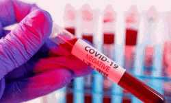 മെഡിക്കല് കോളജില് മരിച്ച കൊണ്ടാഴി സ്വദേശിനിയുടെ കൊവിഡ് പരിശോധനാ ഫലം നെഗറ്റീവ് മെഡിക്കല് കോളജില് മരിച്ച കൊണ്ടാഴി സ്വദേശിനിയുടെ കൊവിഡ് പരിശോധനാ ഫലം നെഗറ്റീവ്