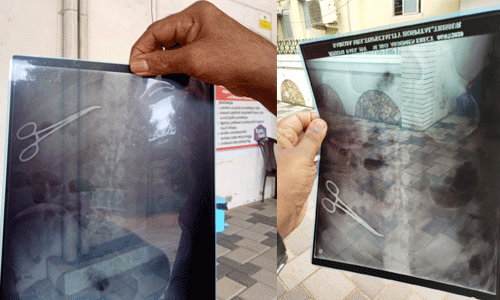 രോഗിയുടെ വയറിനുള്ളില്‍    ശസ്ത്രക്രിയക്കുപയോഗിക്കുന്ന കത്രിക മറന്നുവച്ച സംഭവം; പോലിസ് കേസെടുത്തു