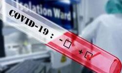 എറണാകുളം ജില്ലയില്‍ ഇന്ന് 79 പേര്‍ക്ക് കൊവിഡ്;75 പേര്‍ക്കും സമ്പര്‍ക്കം വഴി,76 പേര്‍ രോഗ മുക്തി നേടി