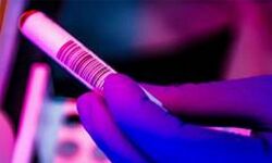 24 മണിക്കൂറിനുള്ളില് തമിഴ്നാട്ടില് 4,965 പേര്ക്ക് കൊവിഡ് സ്ഥിരീകരിച്ചു; 75 മരണം 24 മണിക്കൂറിനുള്ളില് തമിഴ്നാട്ടില് 4,965 പേര്ക്ക് കൊവിഡ് സ്ഥിരീകരിച്ചു; 75 മരണം