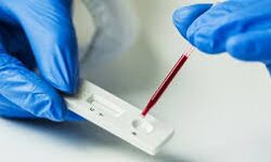 തിരുവനന്തപുരം ജില്ലയിൽ ഇന്ന് 240 പേർക്ക് കൊവിഡ് സ്ഥിരീകരിച്ചു