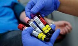 ബംഗളൂരുവില്‍ ഉറവിടമറിയാത്ത 3000ലധികം കൊവിഡ് രോഗികളെ കാണാനില്ല