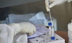 രാജ്യത്ത് റെക്കോഡ് കൊവിഡ് പരിശോധന: തിങ്കളാഴ്ച പരിശോധിച്ചത് 5,28,000 സാംപിളുകള് രാജ്യത്ത് റെക്കോഡ് കൊവിഡ് പരിശോധന: തിങ്കളാഴ്ച പരിശോധിച്ചത് 5,28,000 സാംപിളുകള്