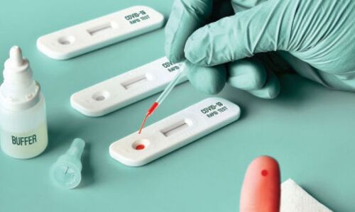 കാസർകോട് 38 പേർക്ക് കൂടി കൊവിഡ് സ്ഥിരീകരിച്ചു