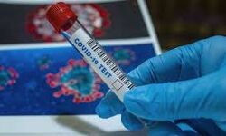 പയ്യോളിയില്‍ മൂന്ന് പേര്‍ക്ക് കൊവിഡ്; കണ്ടെയ്ന്‍മെന്റ് സോണുകള്‍ ഒമ്പതായി