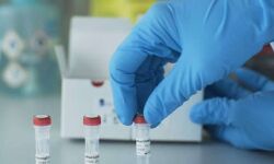 പാലക്കാട് 38 പേര്ക്ക് കോവിഡ് 19 സ്ഥിരീകരിച്ചു: 29 പേര്ക്ക് രോഗമുക്തി പാലക്കാട് 38 പേര്ക്ക് കോവിഡ് 19 സ്ഥിരീകരിച്ചു: 29 പേര്ക്ക് രോഗമുക്തി