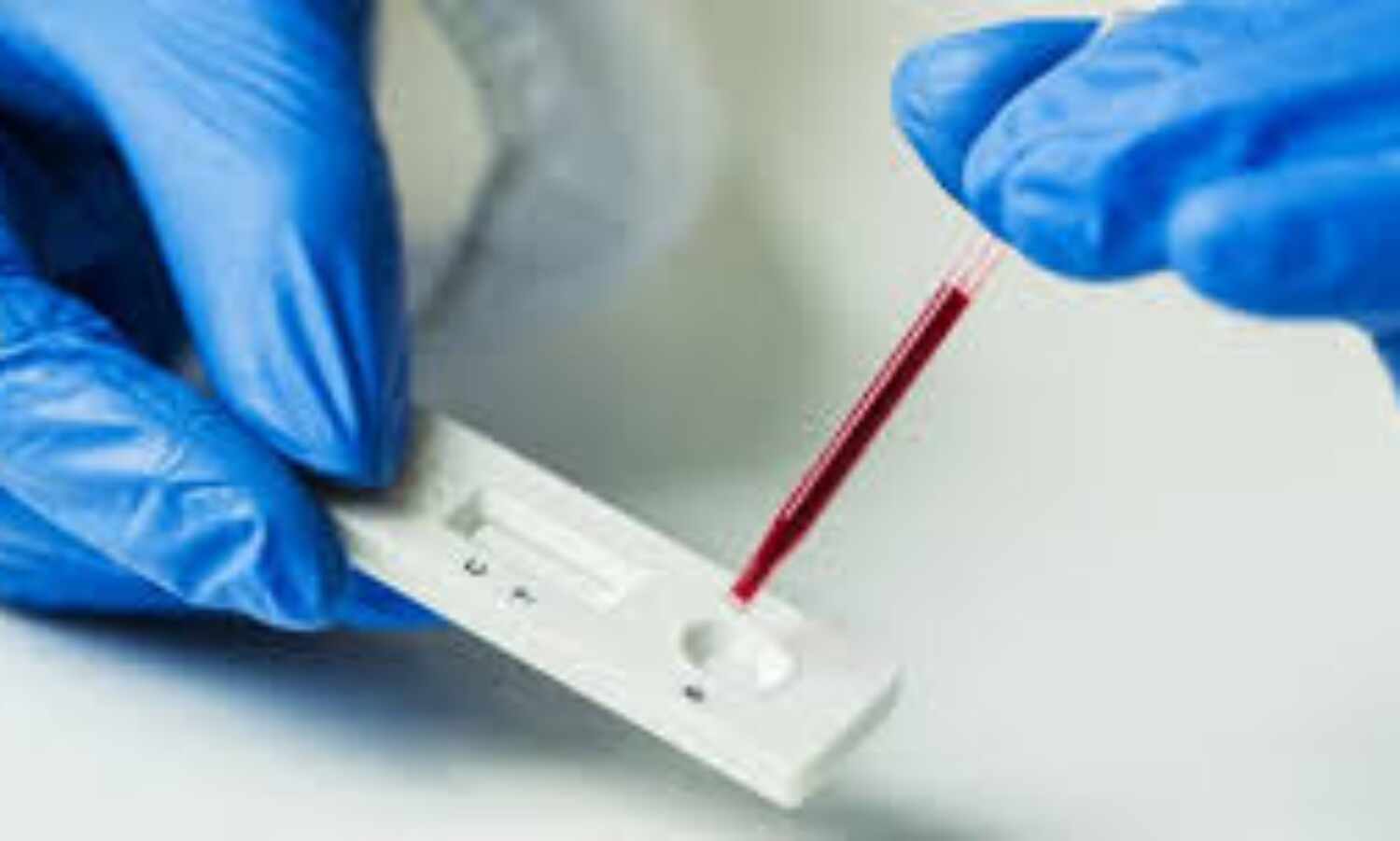 സംസ്ഥാനത്ത് വീണ്ടും കൊവിഡ് മരണം; മരിച്ചത് അഞ്ചുതെങ്ങ് സ്വദേശി സംസ്ഥാനത്ത് വീണ്ടും കൊവിഡ് മരണം; മരിച്ചത് അഞ്ചുതെങ്ങ് സ്വദേശി