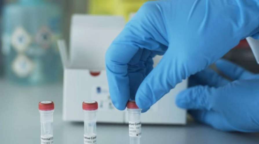 കോഴിക്കോട് 13,324 പേര്‍ നിരീക്ഷണത്തില്‍