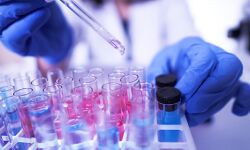 അഞ്ചുതെങ്ങില് ഇന്നലെ 108 പേര്ക്ക് കൂടി കൊവിഡ്; 57 പേര്ക്ക് രോഗമുക്തി അഞ്ചുതെങ്ങില് ഇന്നലെ 108 പേര്ക്ക് കൂടി കൊവിഡ്; 57 പേര്ക്ക് രോഗമുക്തി