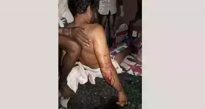 അർധരാത്രിയിൽ വീടുകയറി ഗുണ്ടാ ആക്രമണം; യു​വാ​വി​ന്‍റെ കാ​ലു​ക​ൾ അ​ടി​ച്ചൊ​ടി​ച്ചു