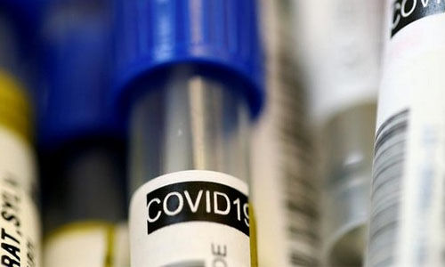 ഇടുക്കി ജില്ലയില് 30 പേര്ക്ക് കൂടി കൊവിഡ് ഇടുക്കി ജില്ലയില് 30 പേര്ക്ക് കൂടി കൊവിഡ്