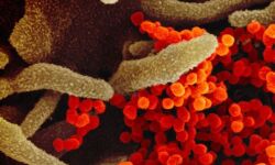 മണിപ്പൂരില്‍ 24 മണിക്കൂറിനുളളില്‍ 130 പേര്‍ക്ക് കൊവിഡ് സ്ഥിരീകരിച്ചു; ഒരാള്‍ മരിച്ചു