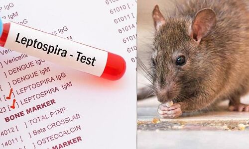 എലിപ്പനി ലക്ഷണങ്ങളോടെ വയനാട്ടില്‍ ഒരു മരണം