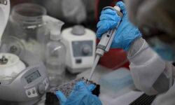 കണ്ണൂര്‍ ജില്ലയില്‍ 112 പേര്‍ക്ക് കൂടി കൊവിഡ്; 88 പേര്‍ക്ക് സമ്പര്‍ക്കത്തിലൂടെ രോഗബാധ