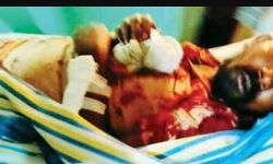 ബിജെപി പ്രവർത്തകന് വെട്ടേറ്റു