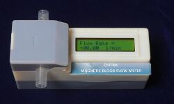 25 ലക്ഷം രൂപ വരുന്ന ഹൃദയ ശസ്ത്രക്രിയാഫലം പരിശോധിക്കുന്ന ബ്ലഡ് ഫ്ലോ മീറ്റര്‍ വികസിപ്പിച്ച് ശ്രീചിത്ര