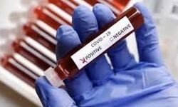 കണ്ണൂര്‍ ജില്ലയില്‍ 207 പേര്‍ക്ക് കൊവിഡ്; 188 പേര്‍ക്ക് സമ്പര്‍ക്കത്തിലൂടെ