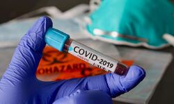 ഇടുക്കിയില്‍ 82 പേര്‍ക്ക് കൂടി കൊവിഡ്