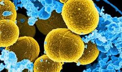 വയനാട്ടില് 44 പേര്ക്ക് കൂടി കൊവിഡ്; 43 പേര്ക്ക് സമ്പര്ക്കത്തിലൂടെ വയനാട്ടില് 44 പേര്ക്ക് കൂടി കൊവിഡ്; 43 പേര്ക്ക് സമ്പര്ക്കത്തിലൂടെ