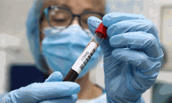 മാളയില്‍ 44 പേര്‍ക്ക് കൊവിഡ്