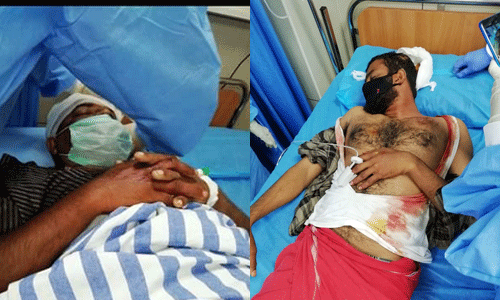 ന്യൂമാഹിയില് ആര്എസ്എസ് ആക്രമണം; മൂന്ന് സിപിഎം പ്രവര്ത്തകര്ക്ക് വെട്ടേറ്റു ന്യൂമാഹിയില് ആര്എസ്എസ് ആക്രമണം; മൂന്ന് സിപിഎം പ്രവര്ത്തകര്ക്ക് വെട്ടേറ്റു