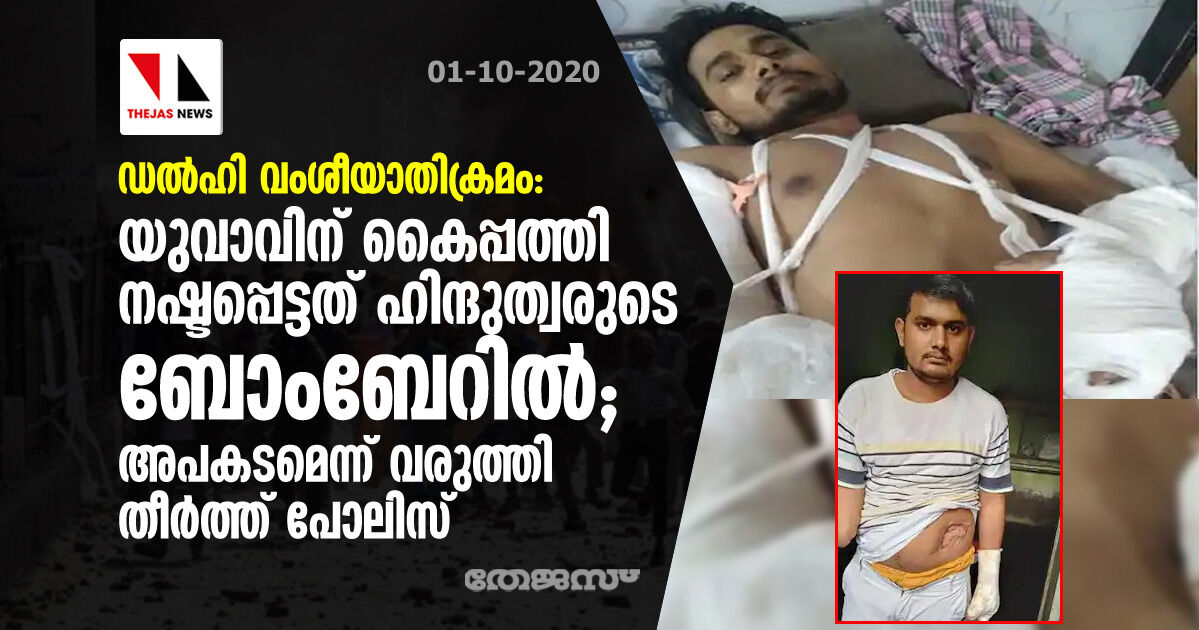 ഡല്‍ഹി വംശീയാതിക്രമം: യുവാവിന് കൈപ്പത്തി നഷ്ടപ്പെട്ടത് ഹിന്ദുത്വരുടെ ബോംബേറില്‍; അപകടമെന്ന് വരുത്തി തീര്‍ത്ത് പോലിസ്