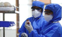 പാലക്കാട് ജില്ലയില് ഇന്ന് 496 പേര്ക്ക് കൊവിഡ് സ്ഥിരീകരിച്ചു പാലക്കാട് ജില്ലയില് ഇന്ന് 496 പേര്ക്ക് കൊവിഡ് സ്ഥിരീകരിച്ചു